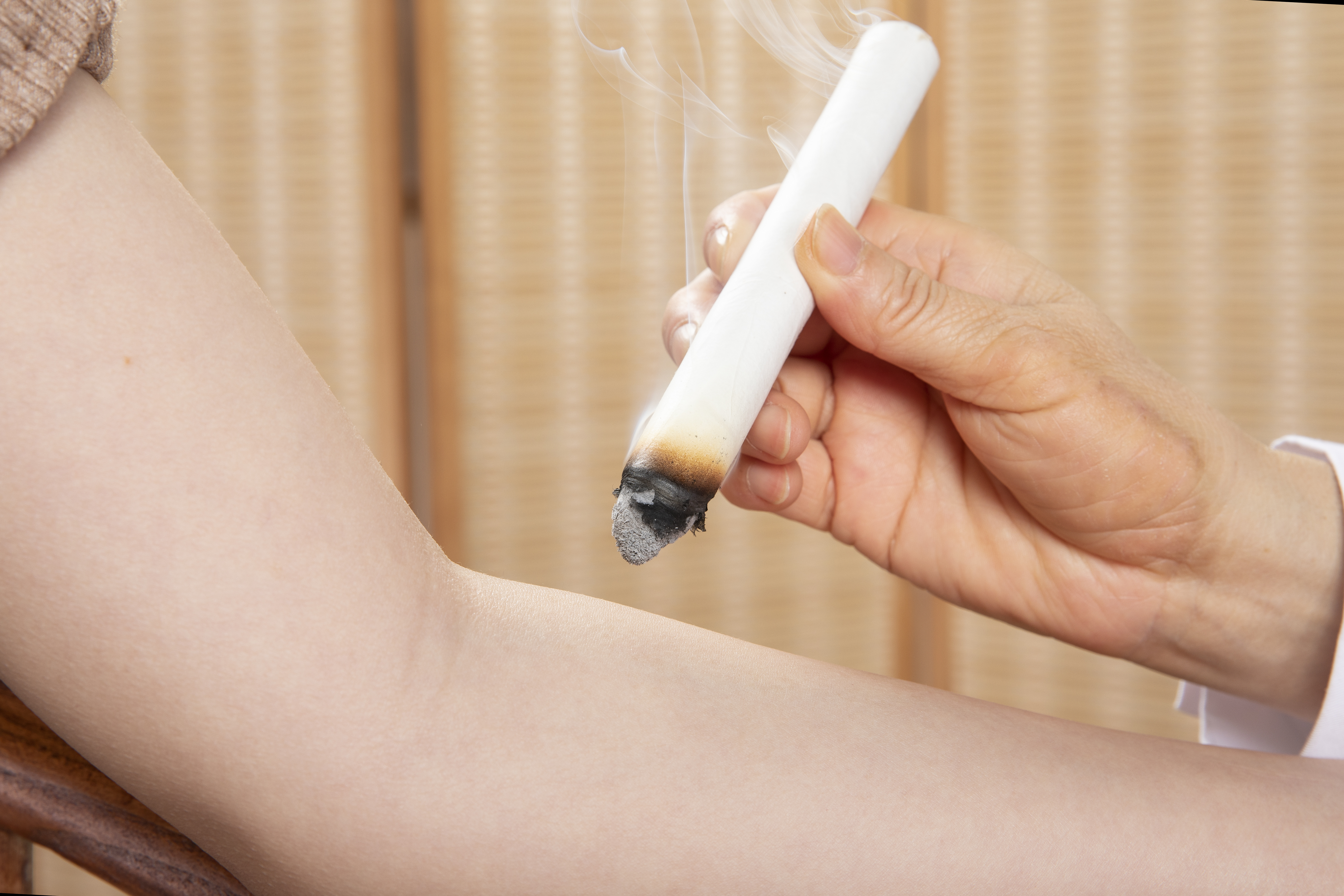 艾灸 | Moxibustion